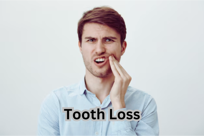 Tooth Loss